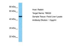 TBX20 Antibody, Novus Biologicals 100 &mu;L | Buy Online | Novus Biologicals | Fisher Scientific